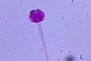 fungal 2.png