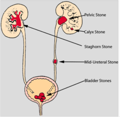Stones 1.png